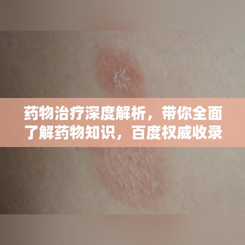 药物治疗深度解析,带你全面了解药物知识,百度权威收录!
