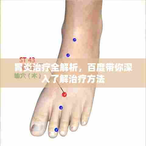 胃炎治疗全解析，百度带你深入了解治疗方法