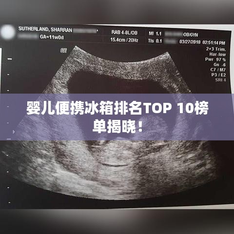 婴儿便携冰箱排名TOP 10榜单揭晓!