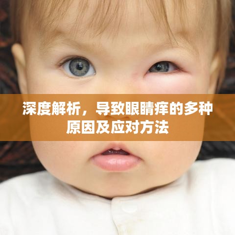 深度解析,导致眼睛痒的多种原因及应对方法